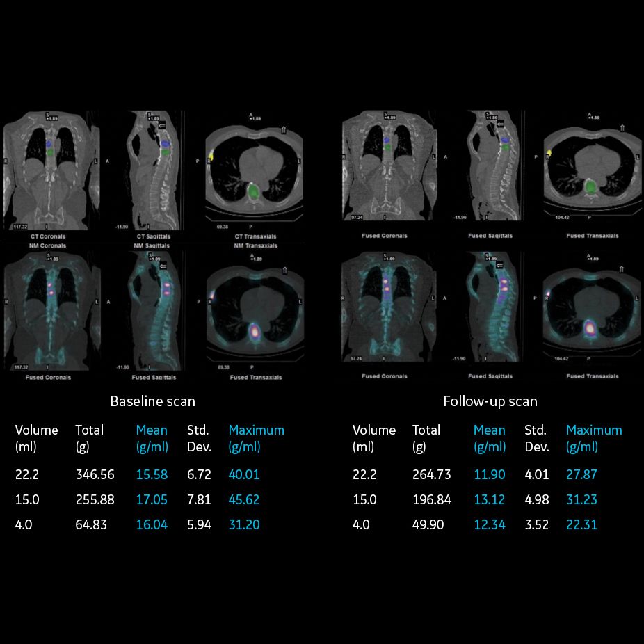 Оборудование ядерной медицины GE Healthcare NM/CT 870 CZT