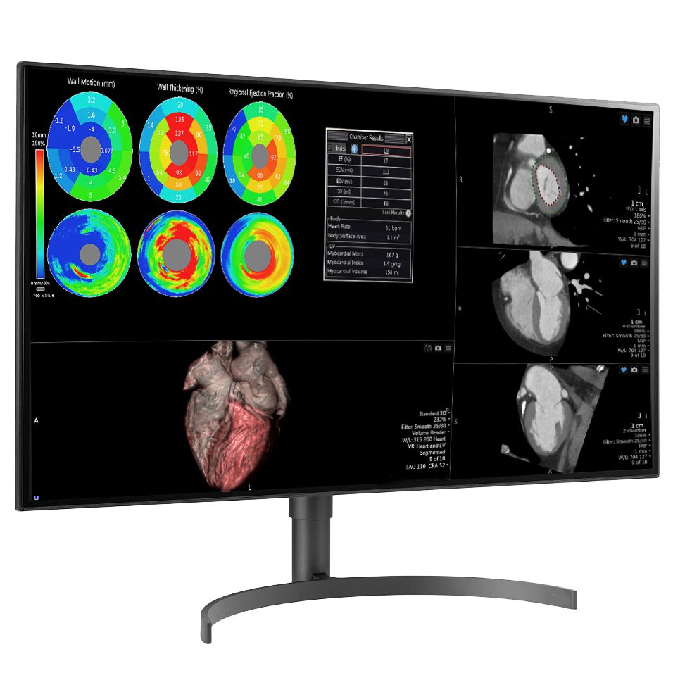 Медицинский монитор Double Black Imaging 32 Color 8MP Large Format Display