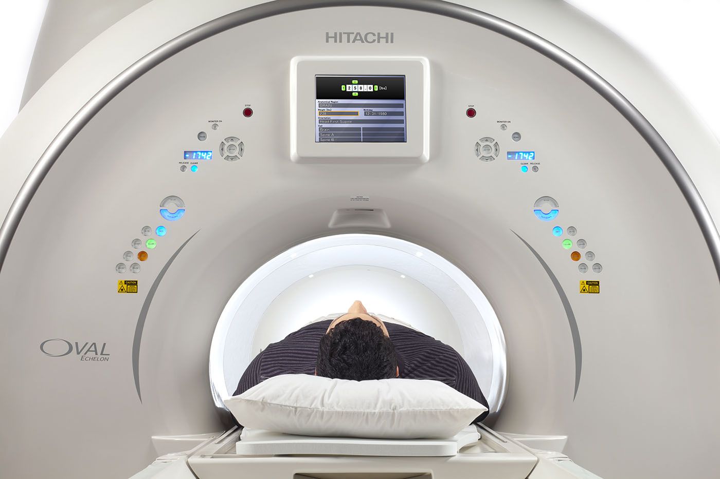Магнитно-резонансный томограф Hitachi Echelon Oval