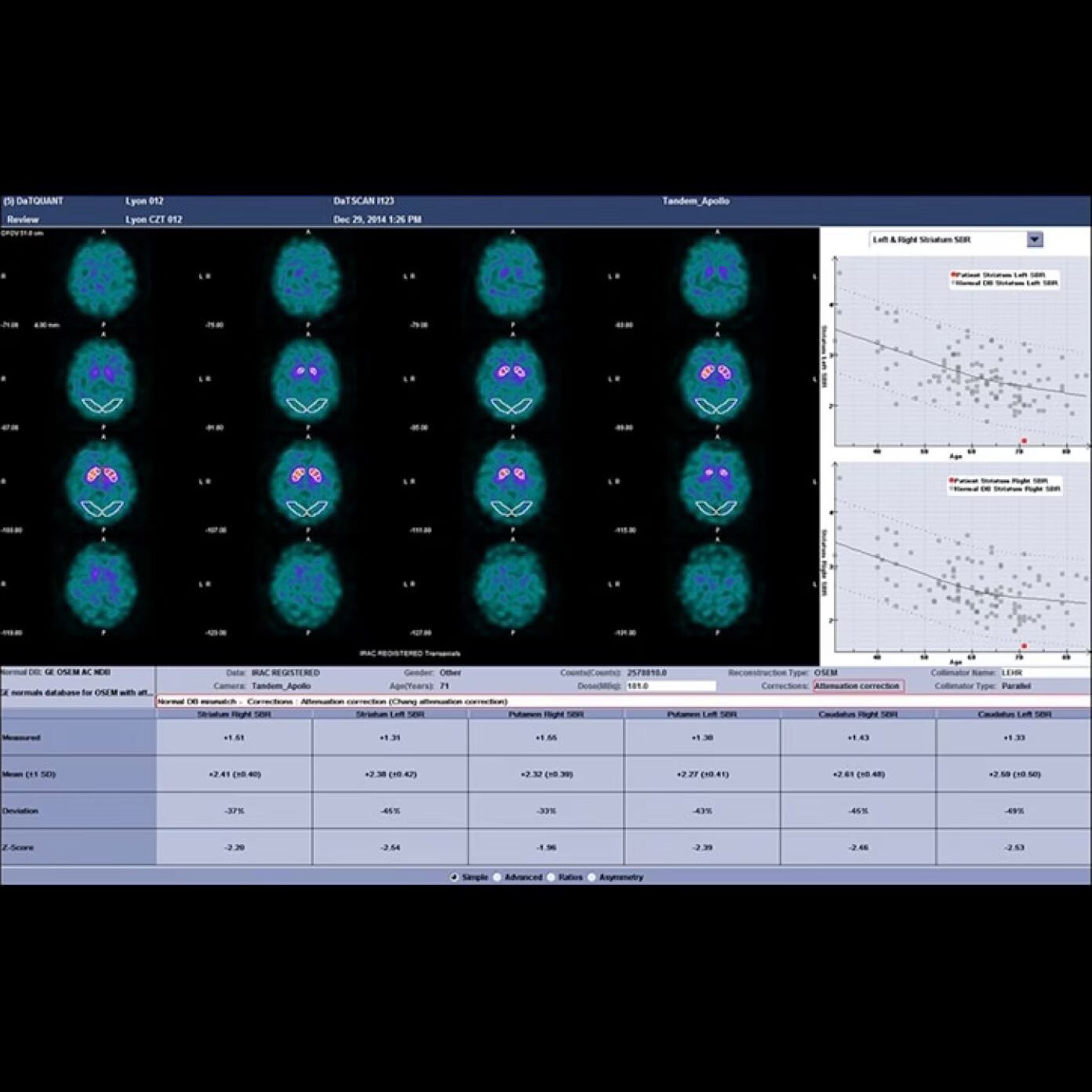 Оборудование ядерной медицины GE Healthcare NM/CT 870 DR